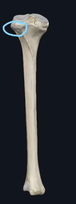 <p>What part of the tibia is this</p>