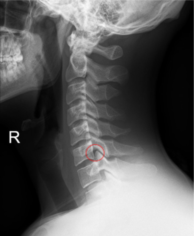 term image
