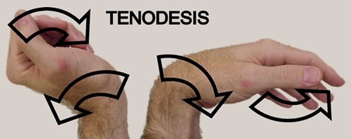 <p>the synergistic coupling of wrist extension with finger flexion and wrist flexion with finger extension</p><p>shows soft tissues are normal</p>
