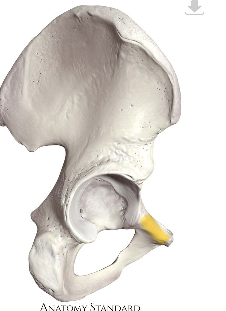 <p>Hoe heet dit deel?</p>