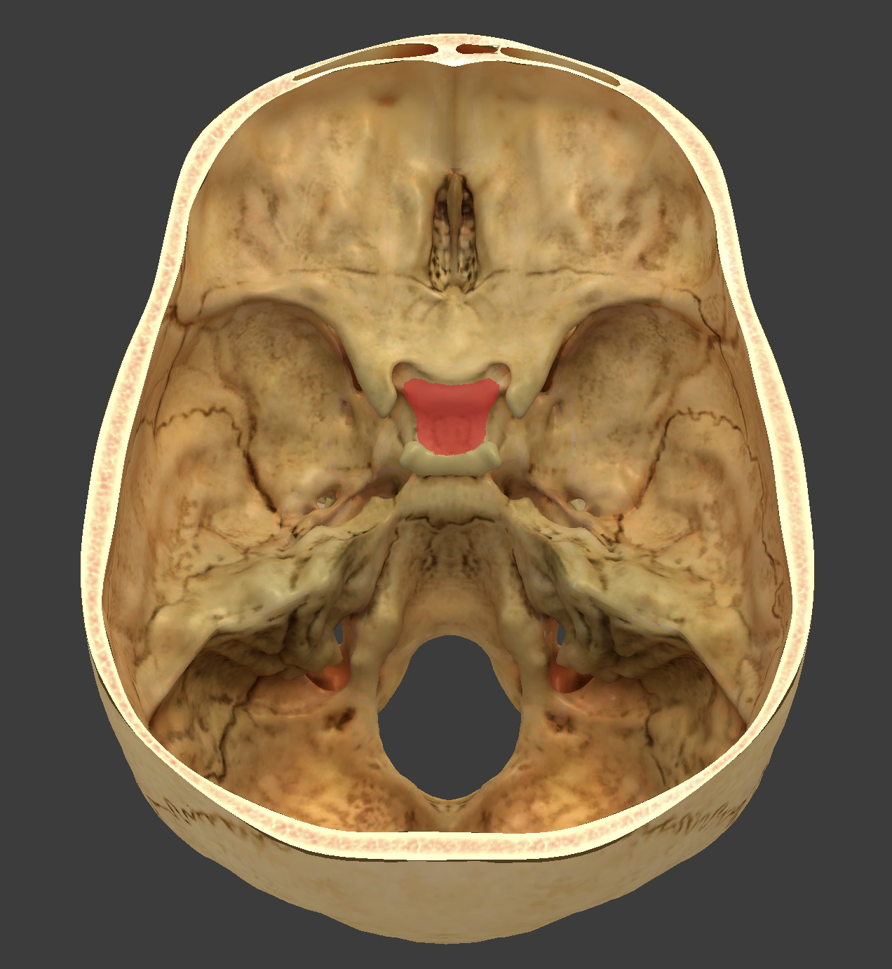 term image