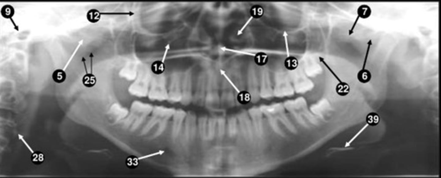 <p>17</p>