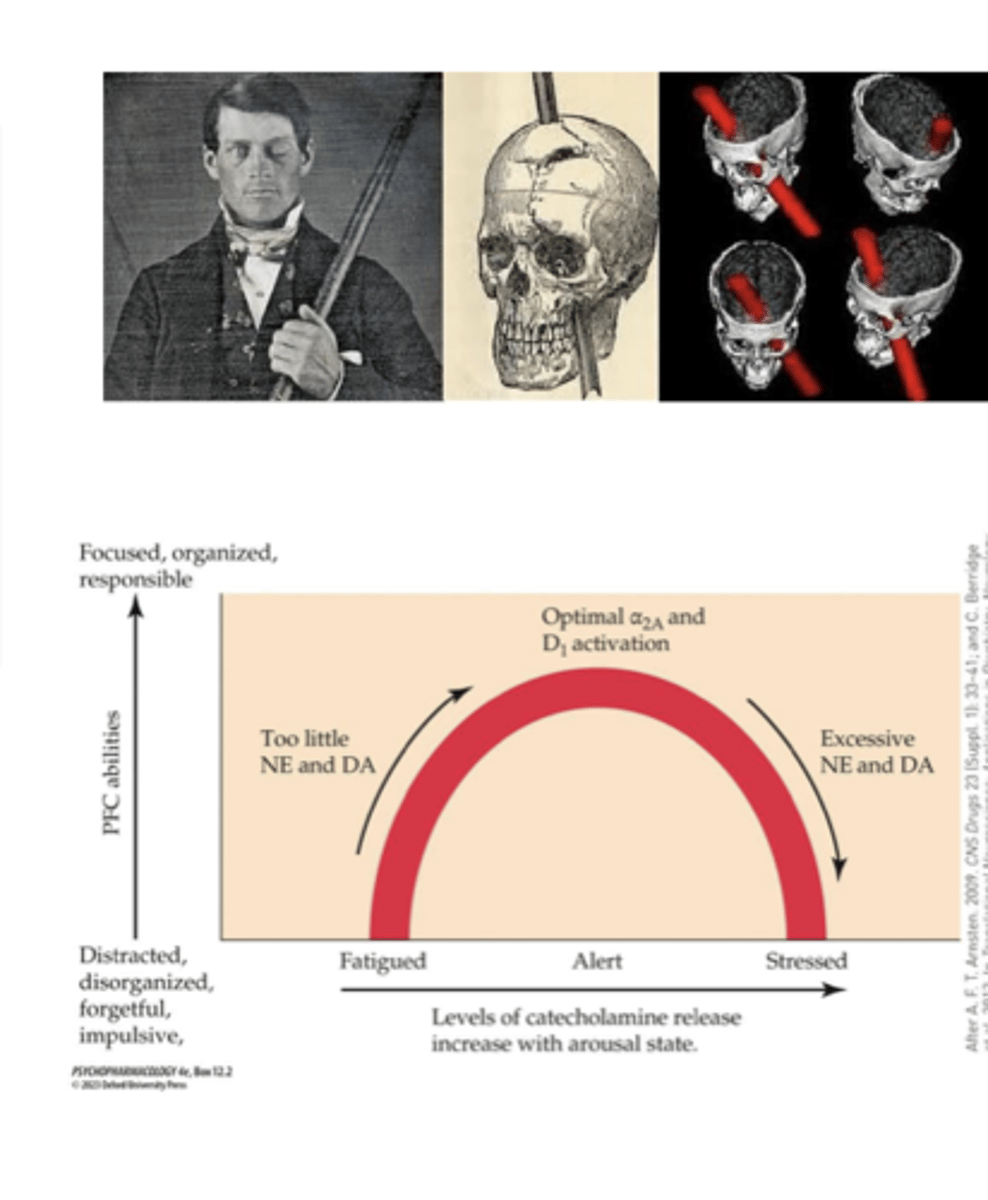 <p>inverted U-shaped function mediated by the activity of catecholaminergic systems</p><p>- ADHD meds enhance catecholaminergic activity in the PFC to restore balance</p><p>- ADHD is fatigued state</p><p>too much catecholamine can have negative effects</p>