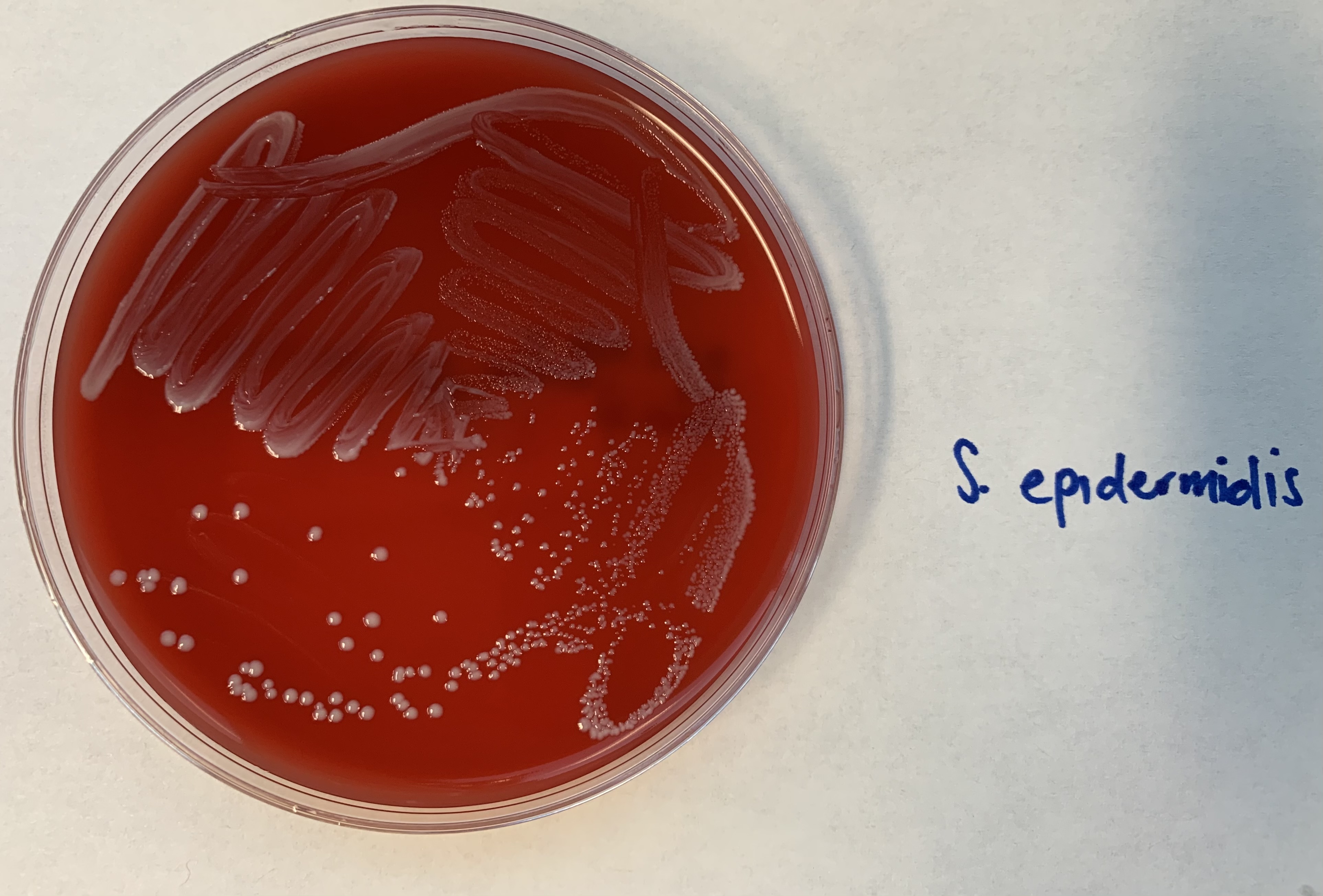 <p>This is a Gamma HEMOLYSIN test, what does this indicate?</p>