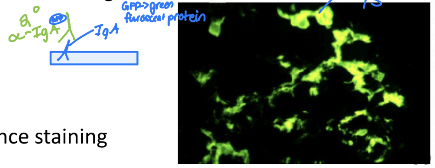 <p>pathogensis of IgA Nephropathy</p>