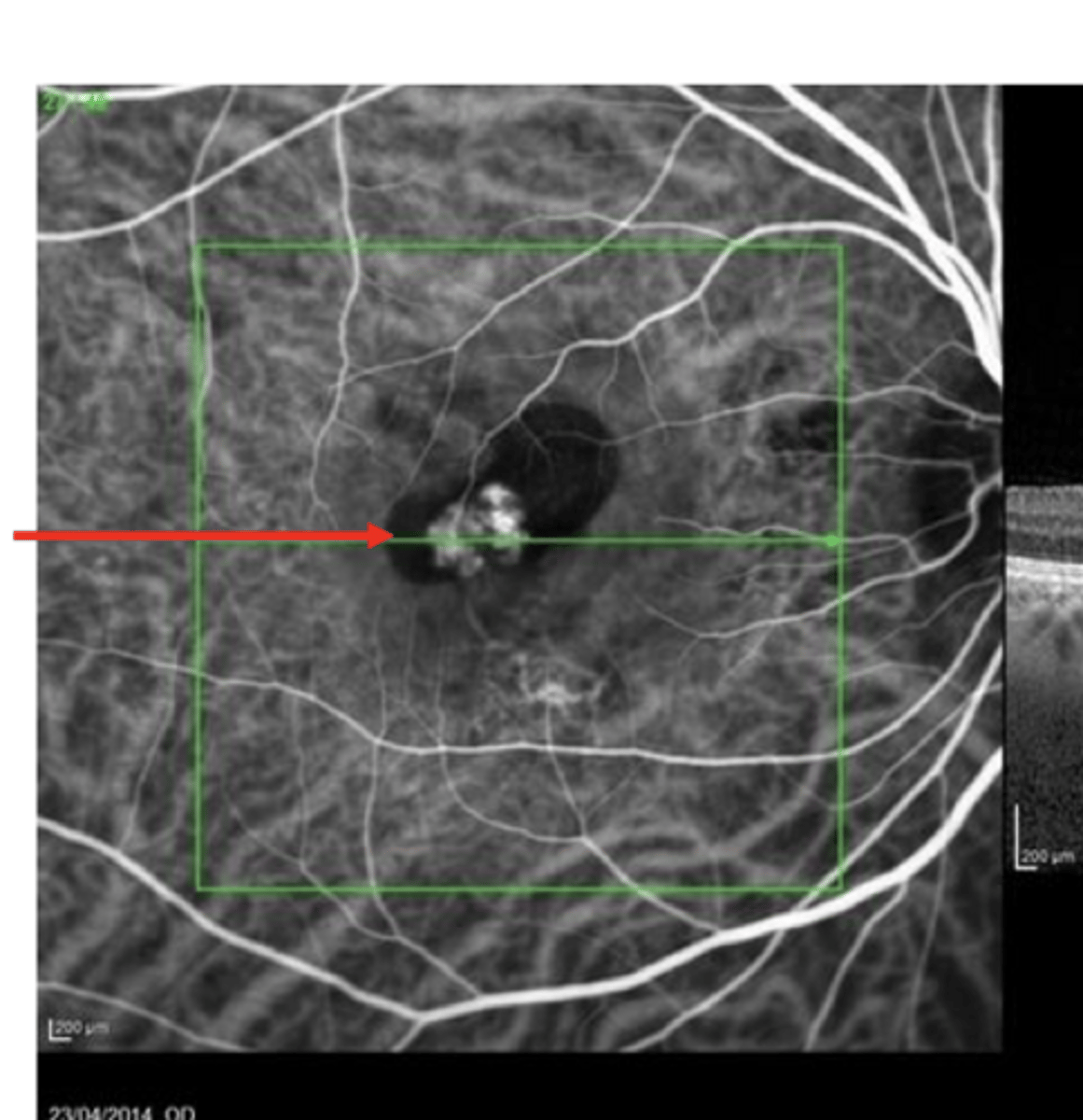 <p>What are these bright bulbs on OCT-1?</p>