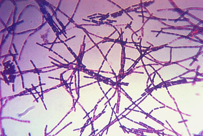 <ol><li><p>What is this bacterium?</p></li><li><p>Shape?</p></li><li><p>What are the little white spots on it?</p></li><li><p>Disease?</p></li></ol>