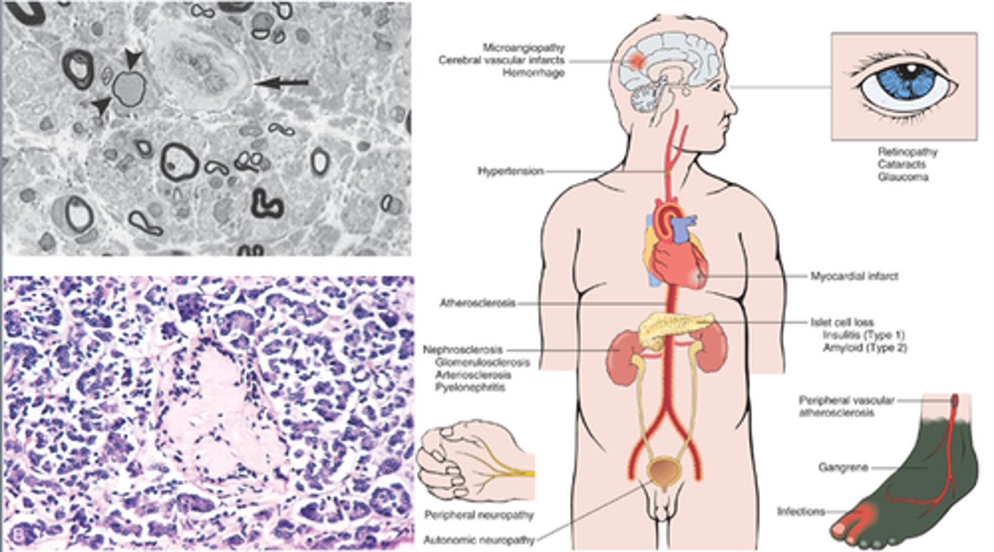 <p>Good cholesterol is called ___ ____________.</p><p>HINT: Keep your ____ HIGH :-)</p>