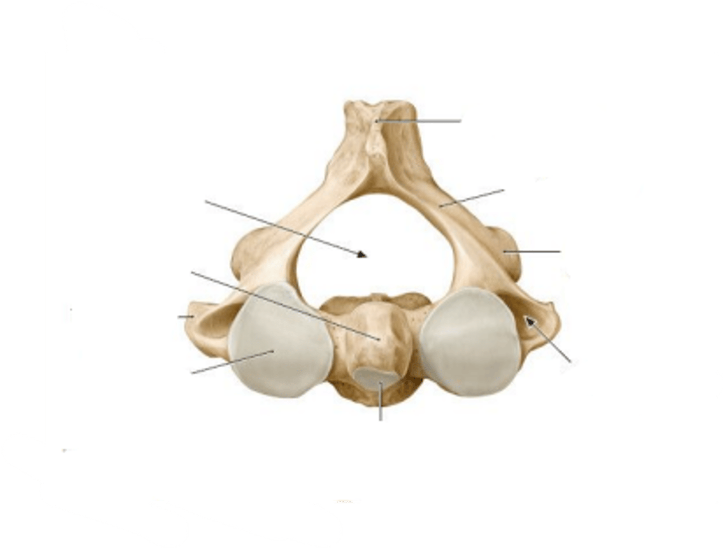 <p>What is the name of the displayed cervical vertebrae?</p>
