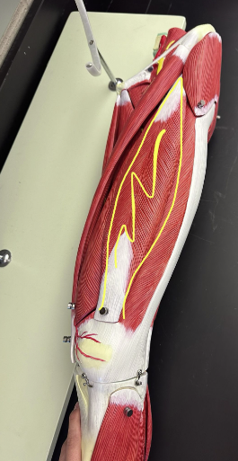 <p>What muscle is the yellow line indicating? What action does this muscle perform?</p>