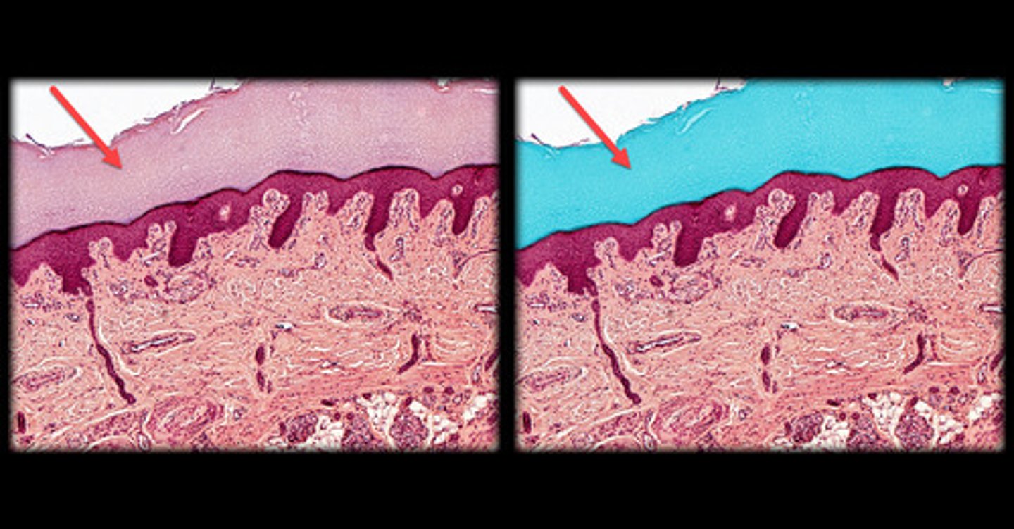 <p>- Outermost layer of the epidermis.</p><p>- Multiple layers of flat, dead keratinized cells.</p><p>- Appears as a thick, dense layer of flattened, anucleate cells (no visible nuclei) under the microscope, often peeling off or sloughing at the surface.</p><p>- Found in both thick and thin skin, but much thicker in areas like the palms and soles.</p>