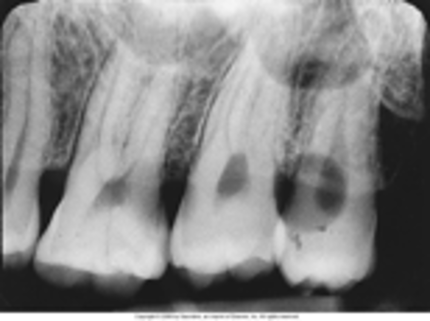 <p>dark or black spots, developer comes in contact with film before processing</p>