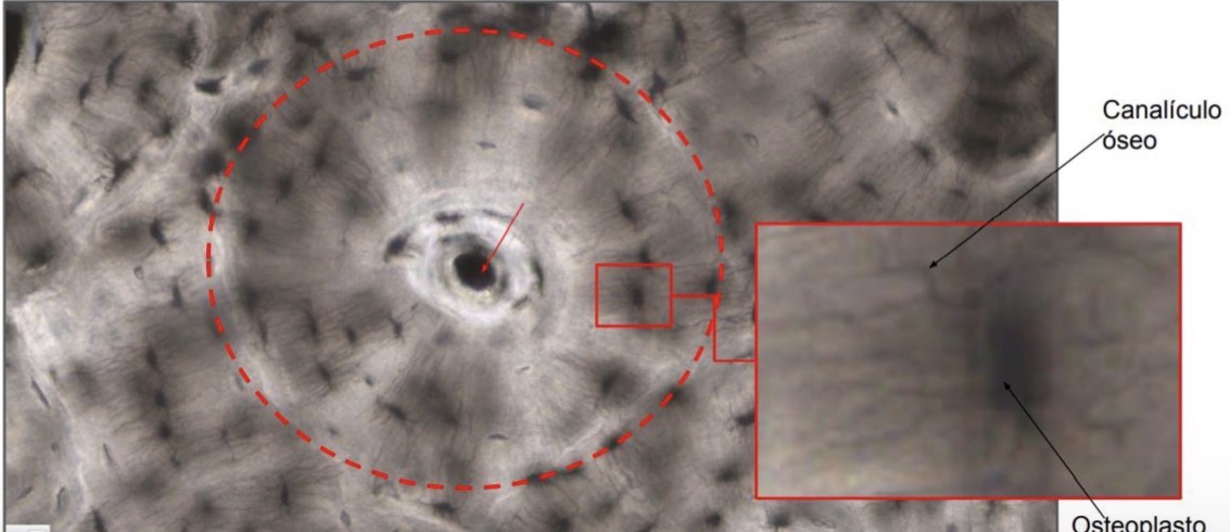 <p>Osteoplasto lagunas óseas </p>