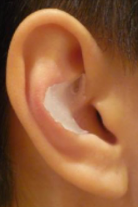 <p>Changes shape of ear but not blocking or clogging ear</p><ul><li><p>Spectral cues were ruined; took away ability to perceive elevation</p></li><li><p>Got better over time when leaving mold in for a few weeks since you learn a new way to perceive sound in your specific ear</p></li><li><p>When they took out the mold the participant was still equally as good as it originally was before</p></li></ul><p></p>