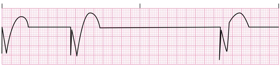 <p>Pacemaker</p>