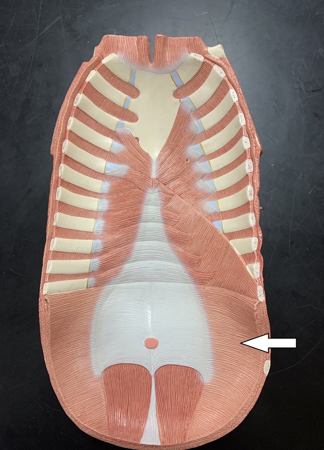 <p><span>Name the muscle labeled with the white arrow below:</span></p>