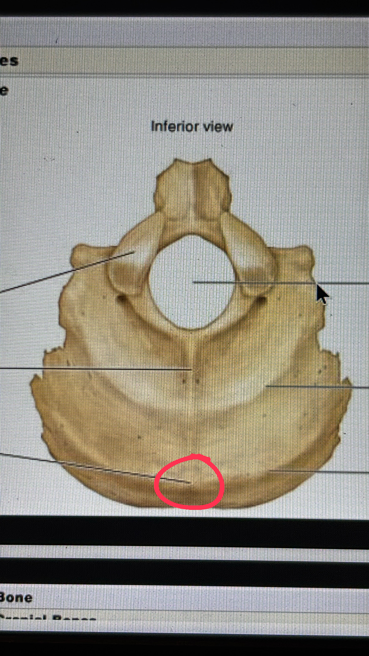 <p>back of head projection (middle</p>