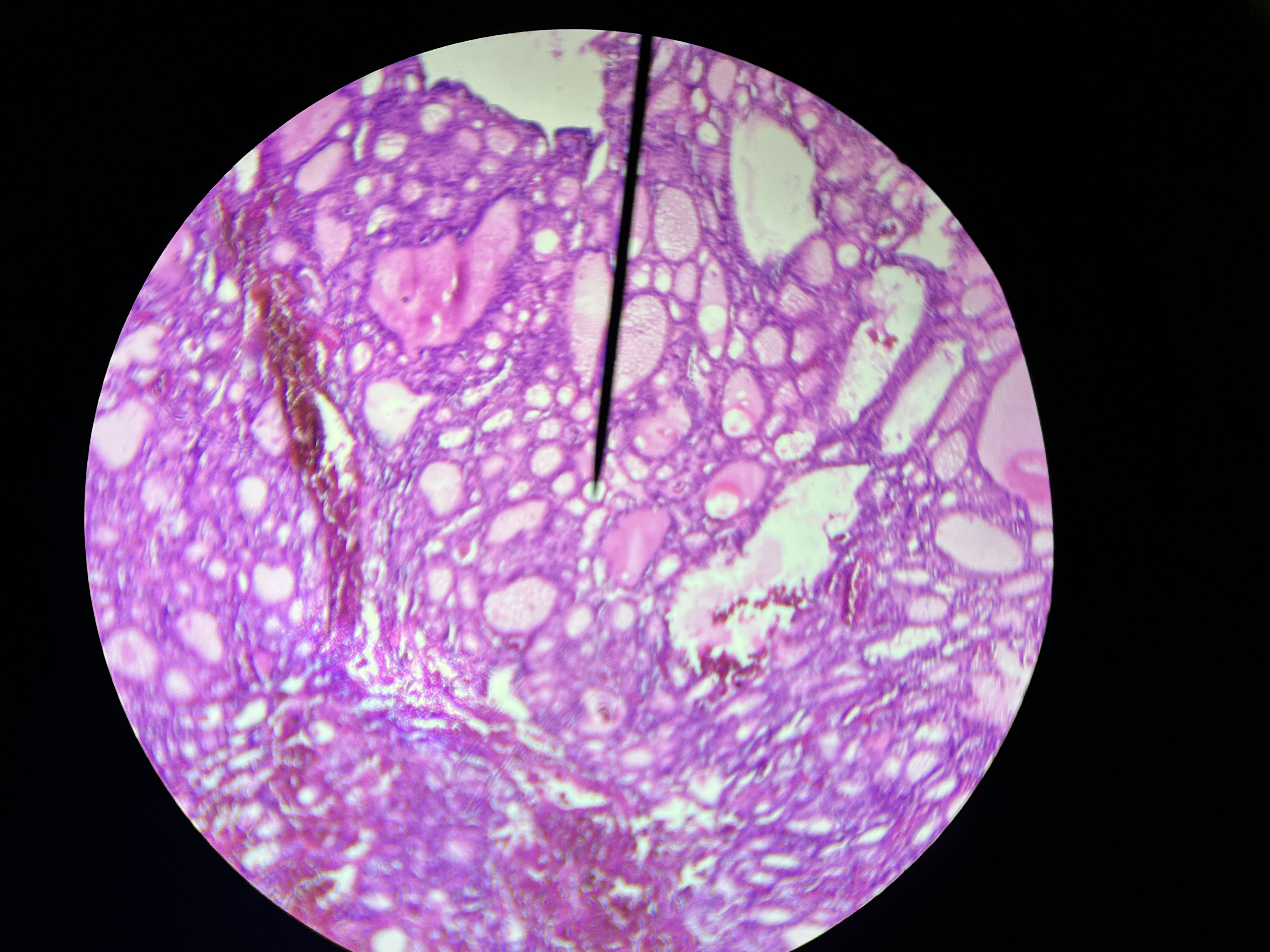 <p>What is the diagnosis?</p>