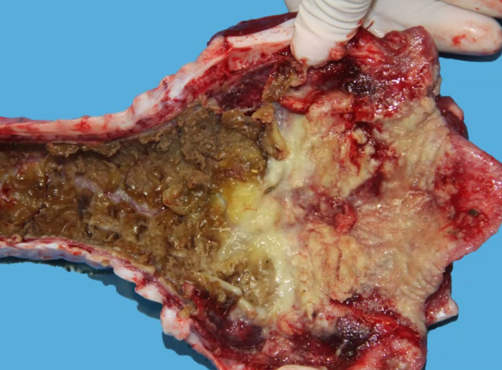 <p>What is the etiology?</p><p>A-Bovine herpesvirus 1</p><p>B-Bovine respiratory syncytial virus</p><p>C-Bovine viral diarrhea virus</p><p>D-Parainfluenza 3 virus</p>