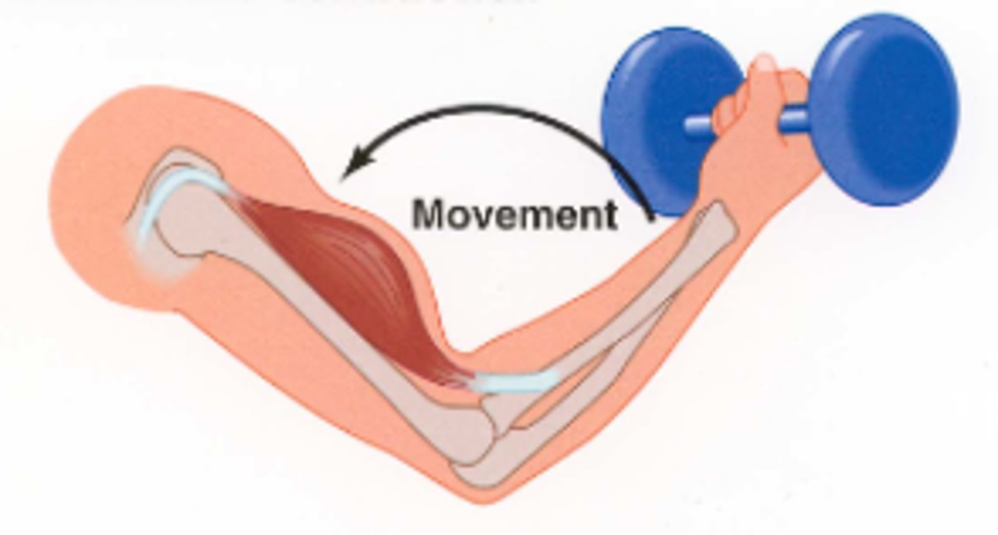 <p>a contraction that creates force and moves a load by shortening the muscle</p>
