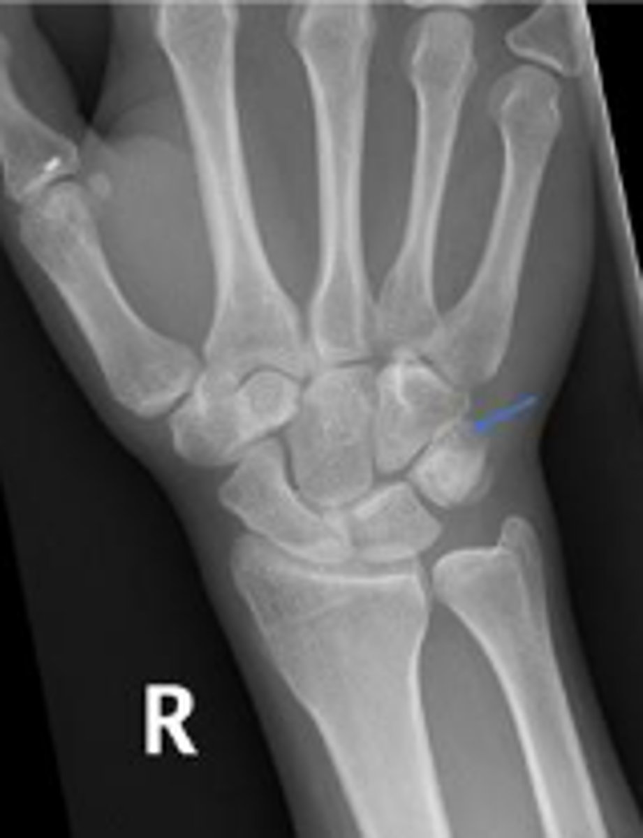 <p>What are the arrows pointing to?</p>