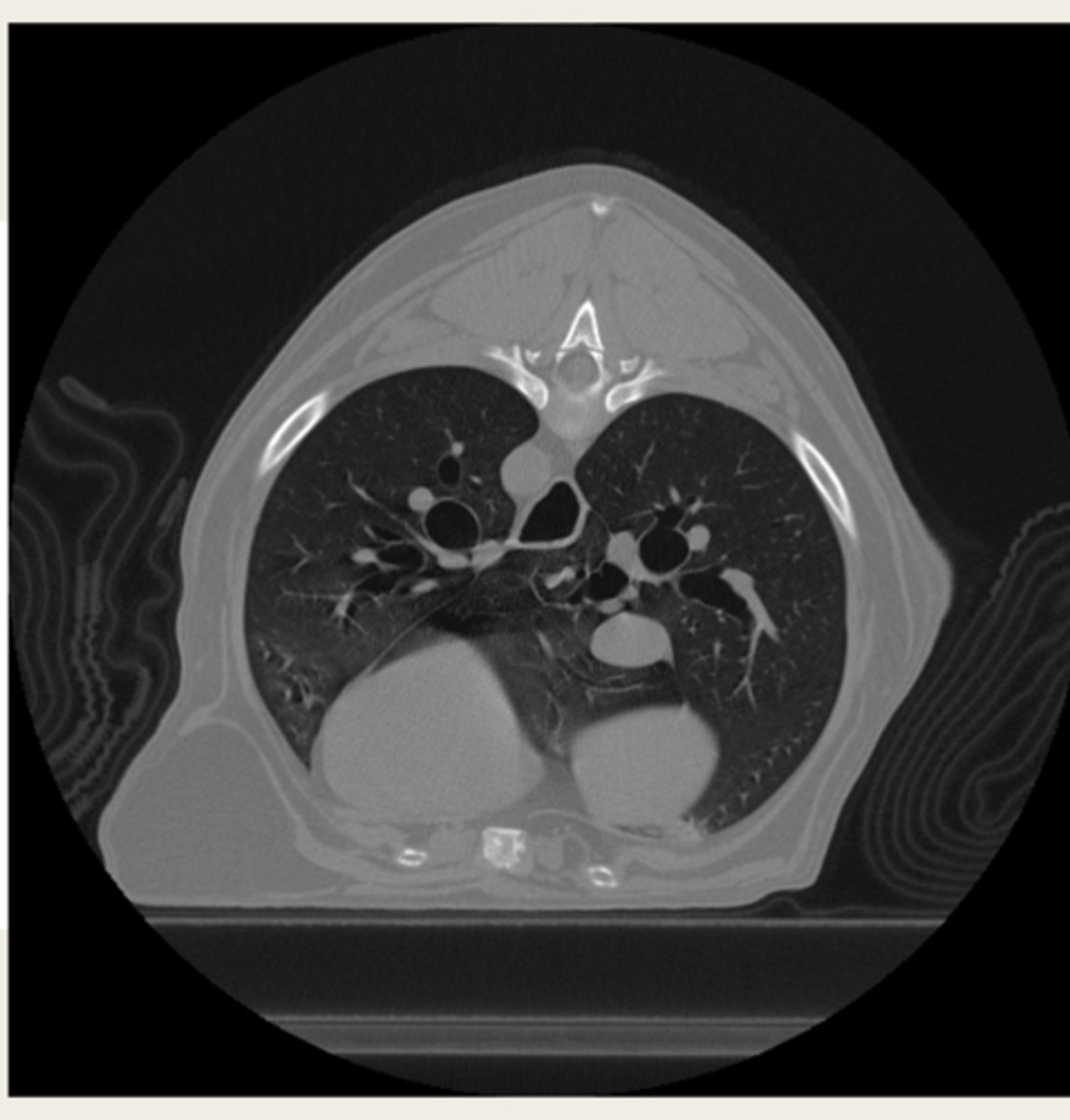 <p>what is this CT measuring?</p>