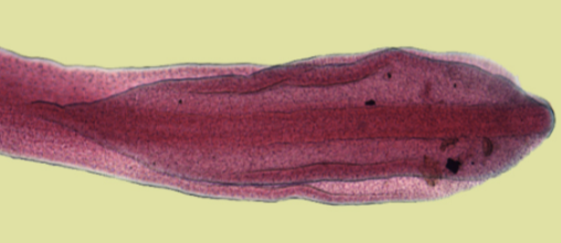 <p>Diphyllobothrium latum </p>