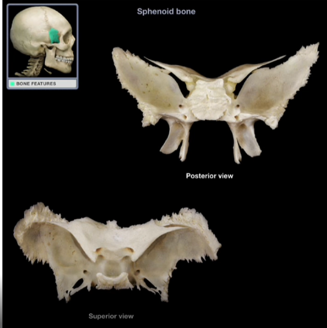 <p>Sphenoid Bone</p>