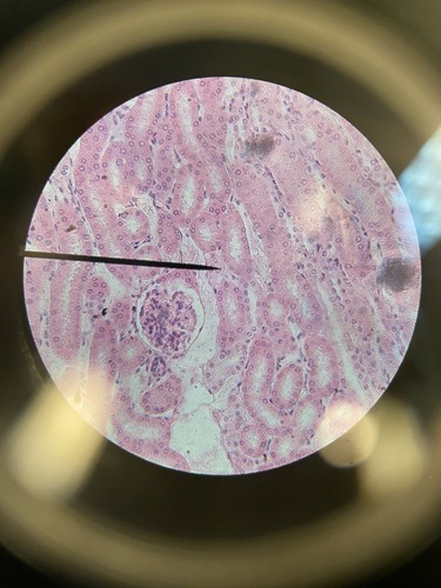 <p>What type of epithelium</p>