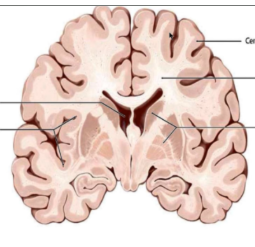 <p>The ventricles are spaces filled with ______ ______.</p>