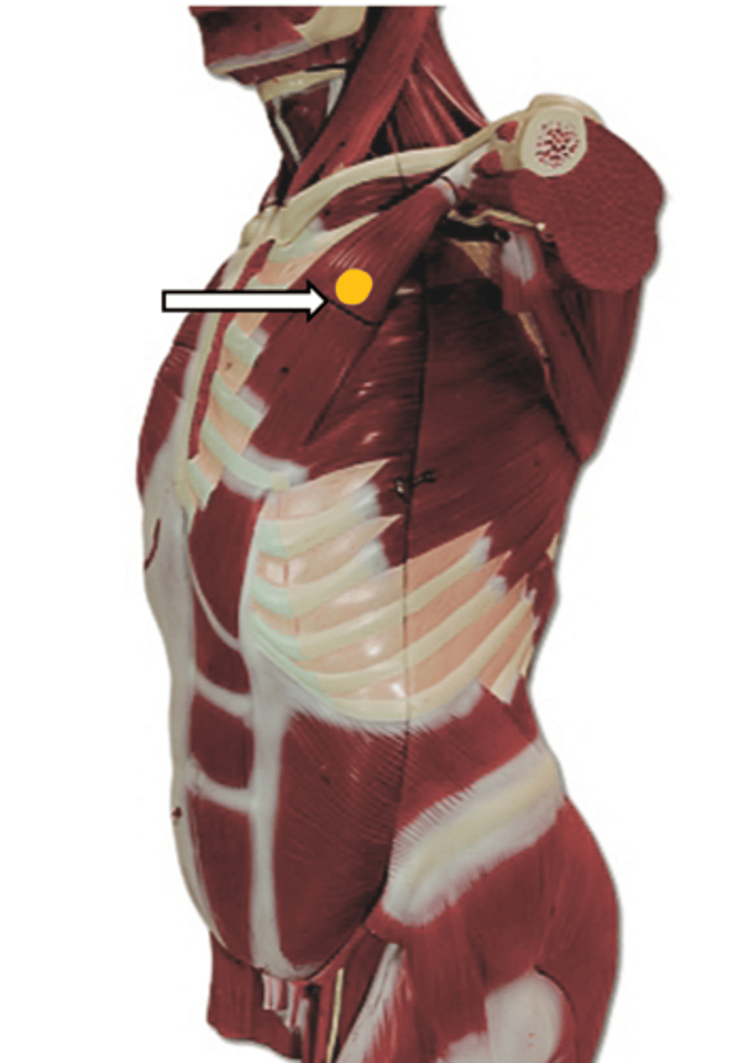 <p>name the muscle</p>