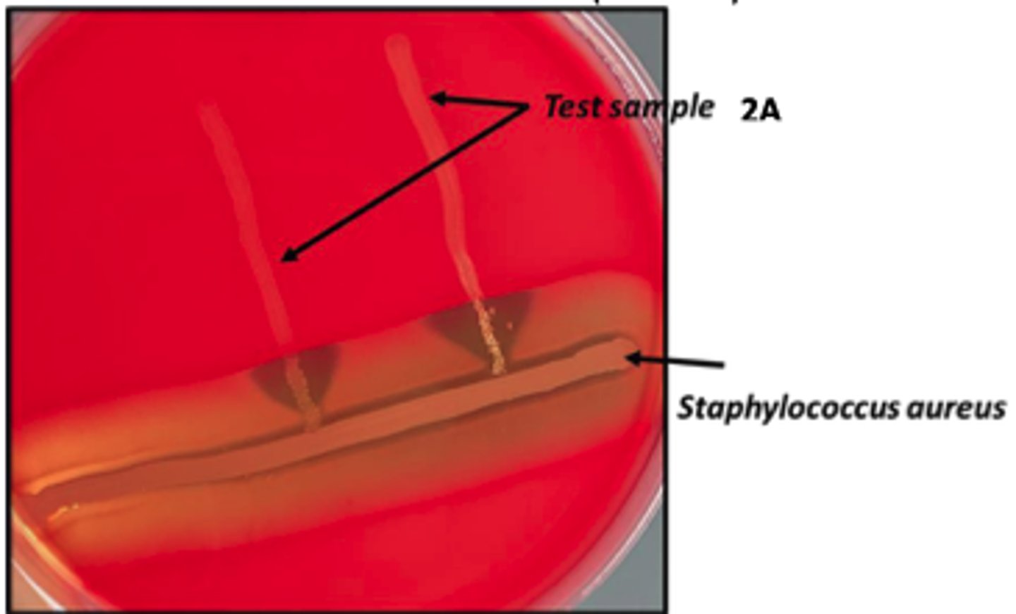 <p>The organisms on the BA plates provided were isolated from a milk specimen of a Holstein cow with acute mastitis. Interpret your CAMP Test</p><p>Presuptive diagnosis ?</p>