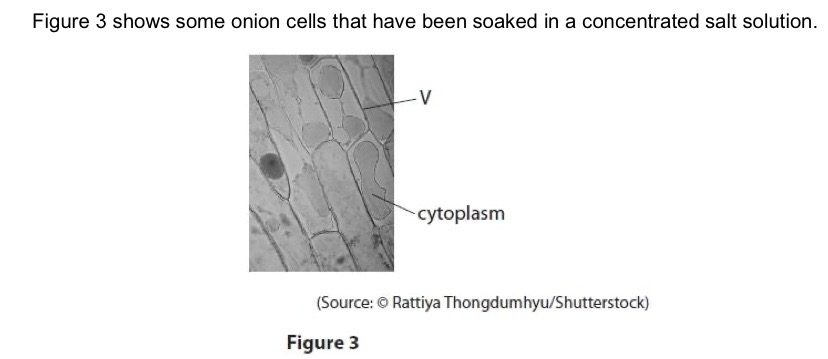 <p>Name the structure labelled V.</p>
