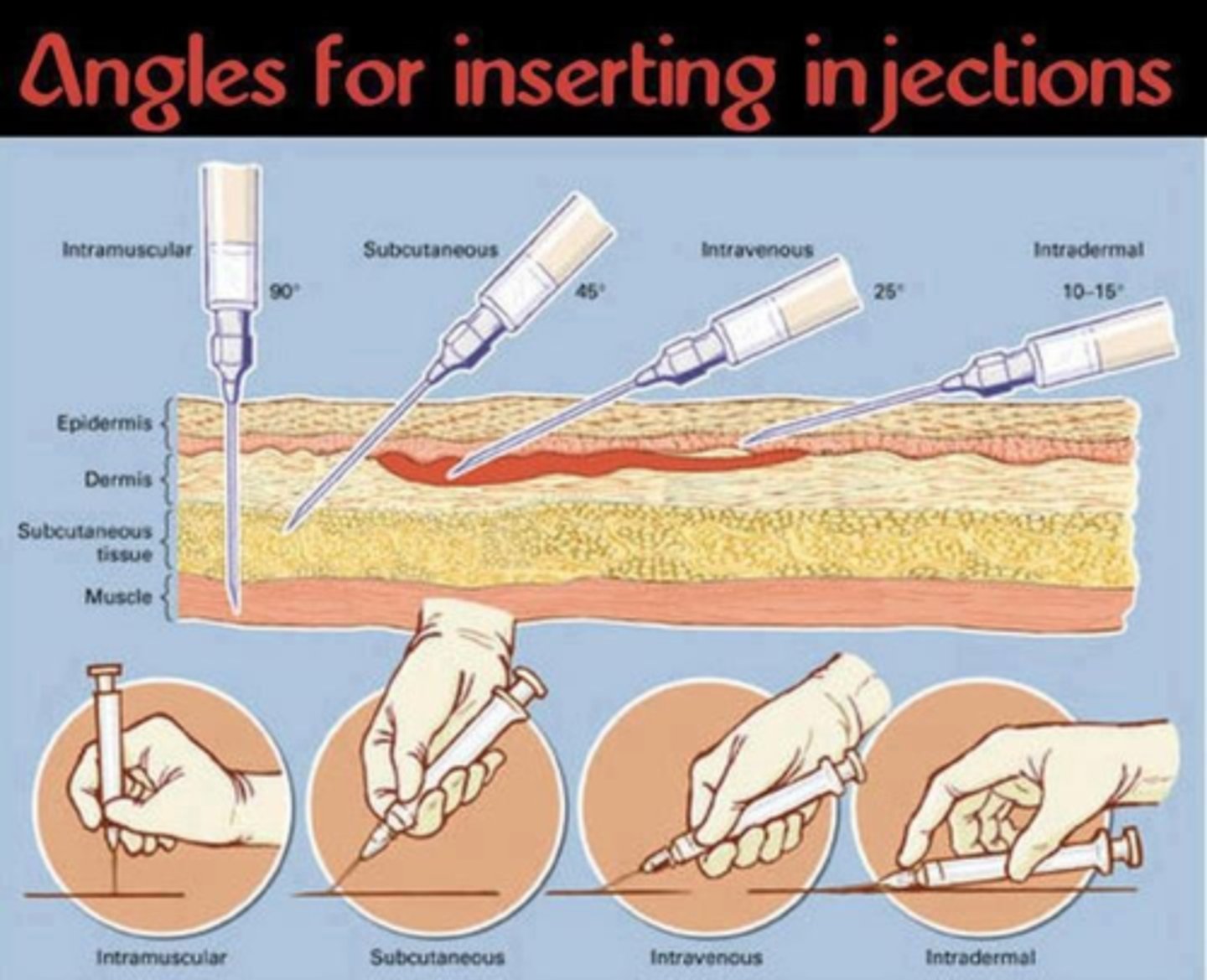 <p>these administration all require an INJECTION</p><p>- ex. Intravenous (IV), Intramuscular (IM), Subcutaneous (SC), Implanted ports</p>