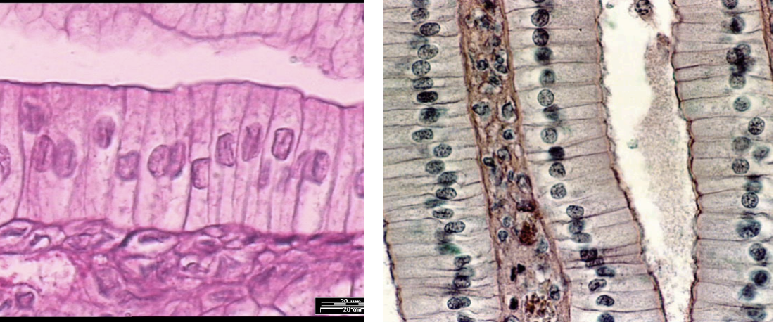 <p>Tissue located in the GI tract and uterine tubes. Functions include secretion and absorption.</p>