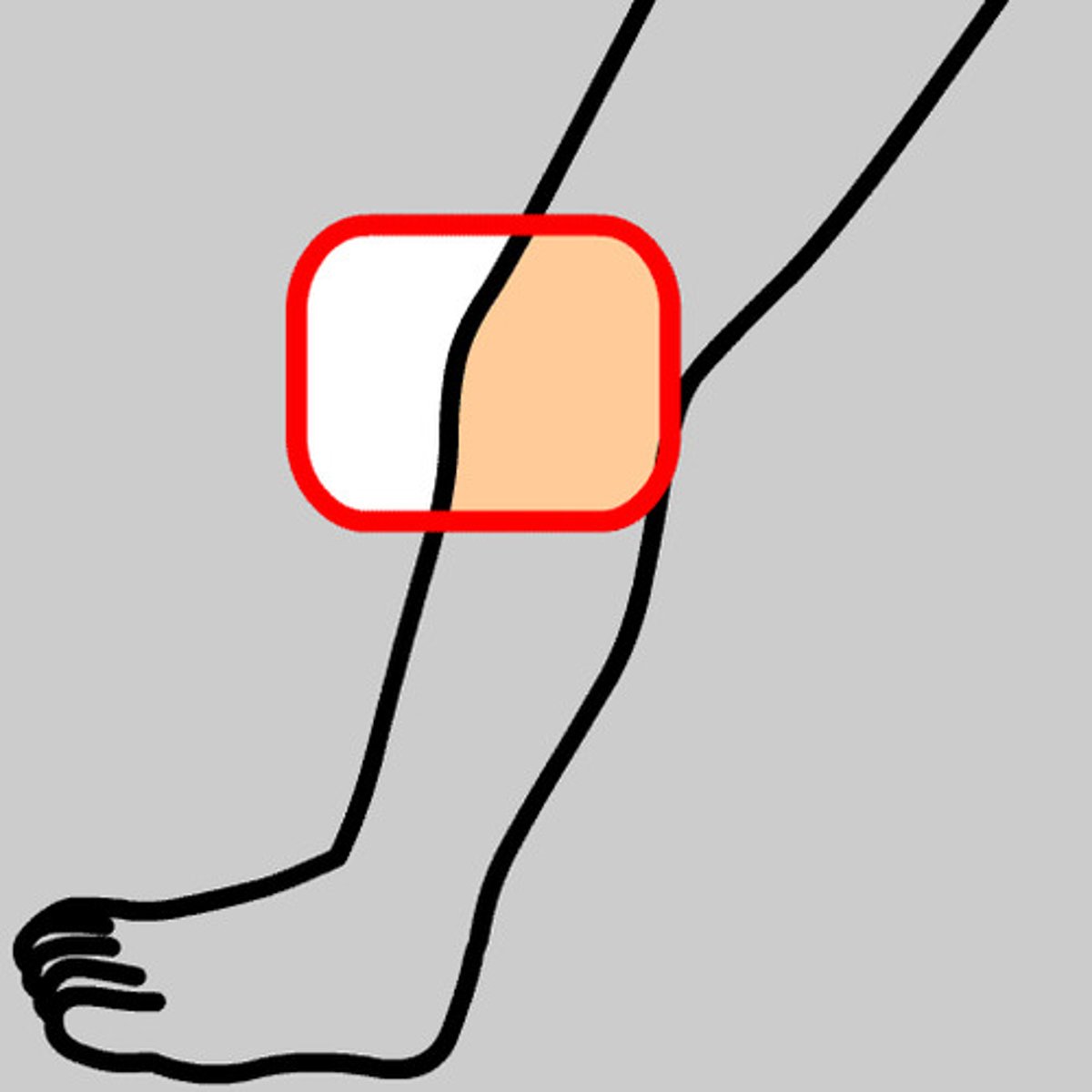 <p>Knee</p>
