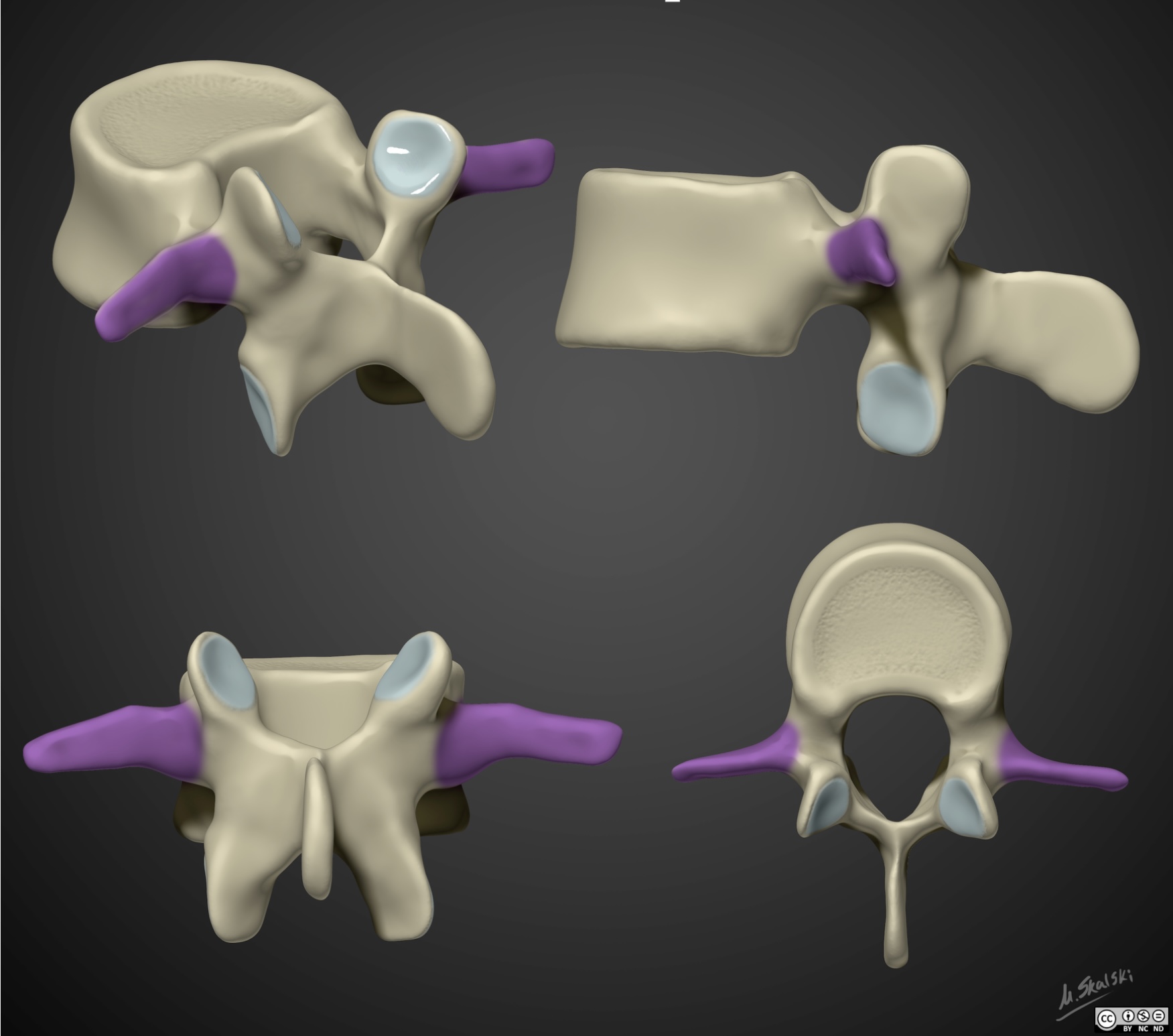 <p>Transverse process</p>