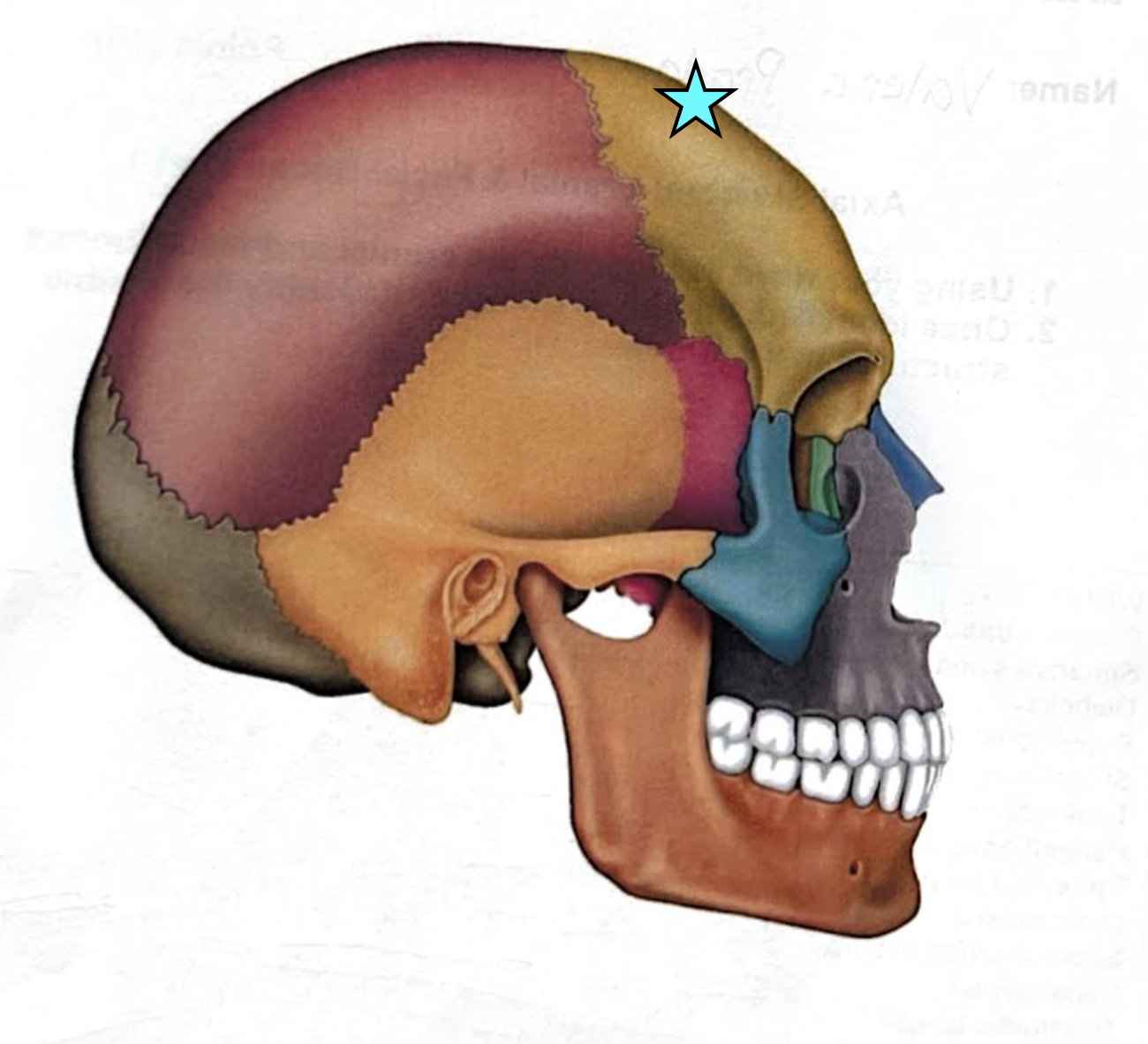 term image