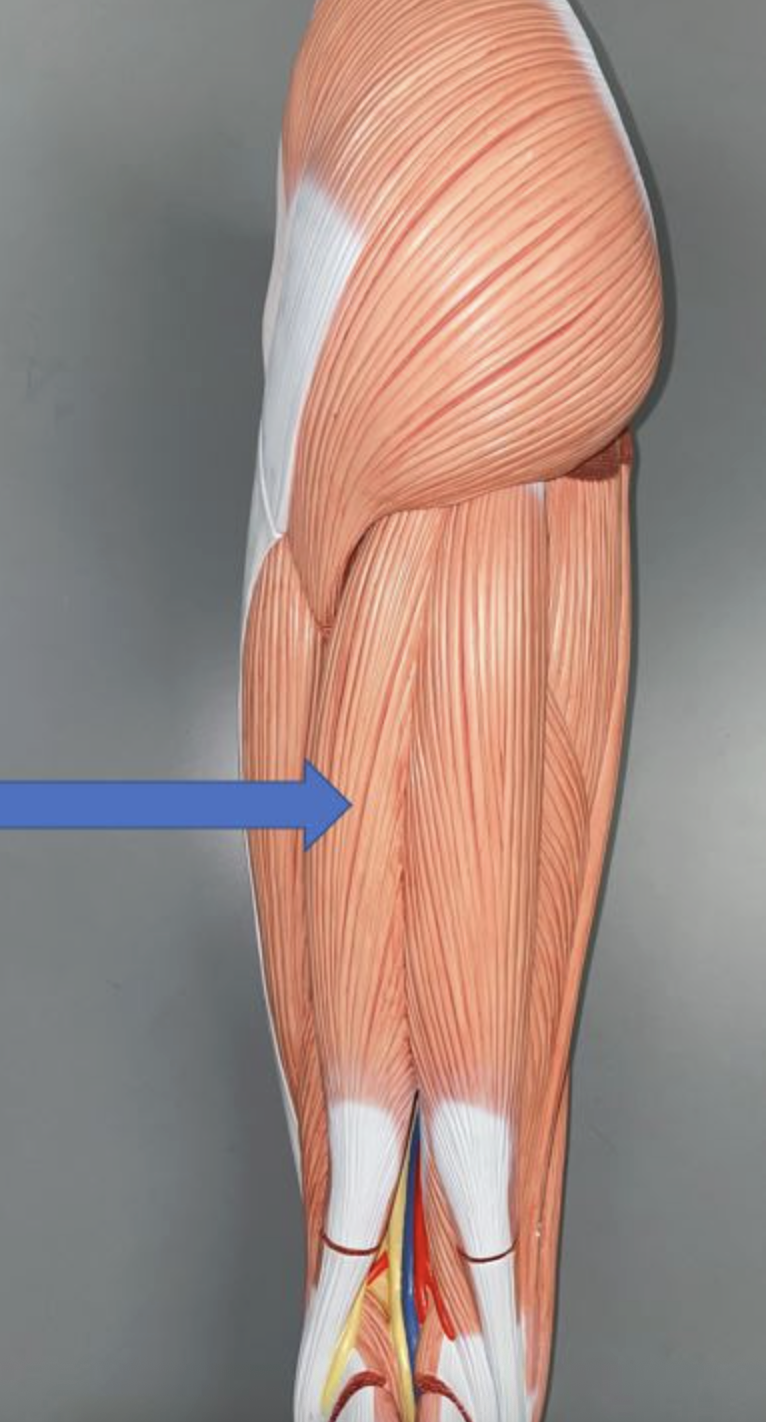 <p>muscle name &amp; action</p>