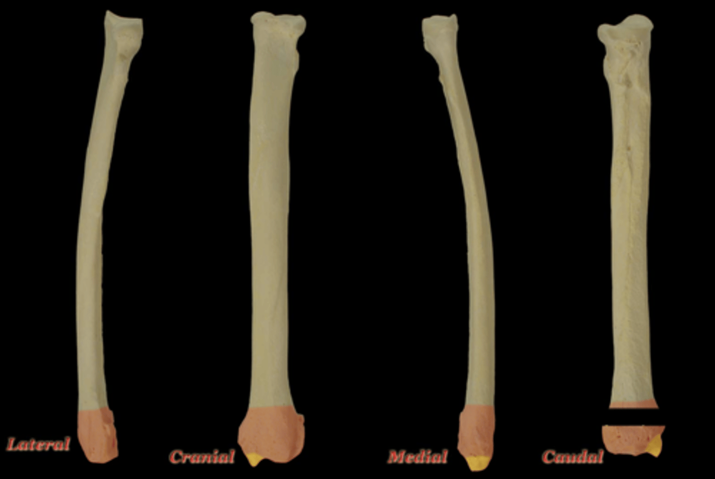 <p>What structure is highlighted in yellow in this picture?</p>
