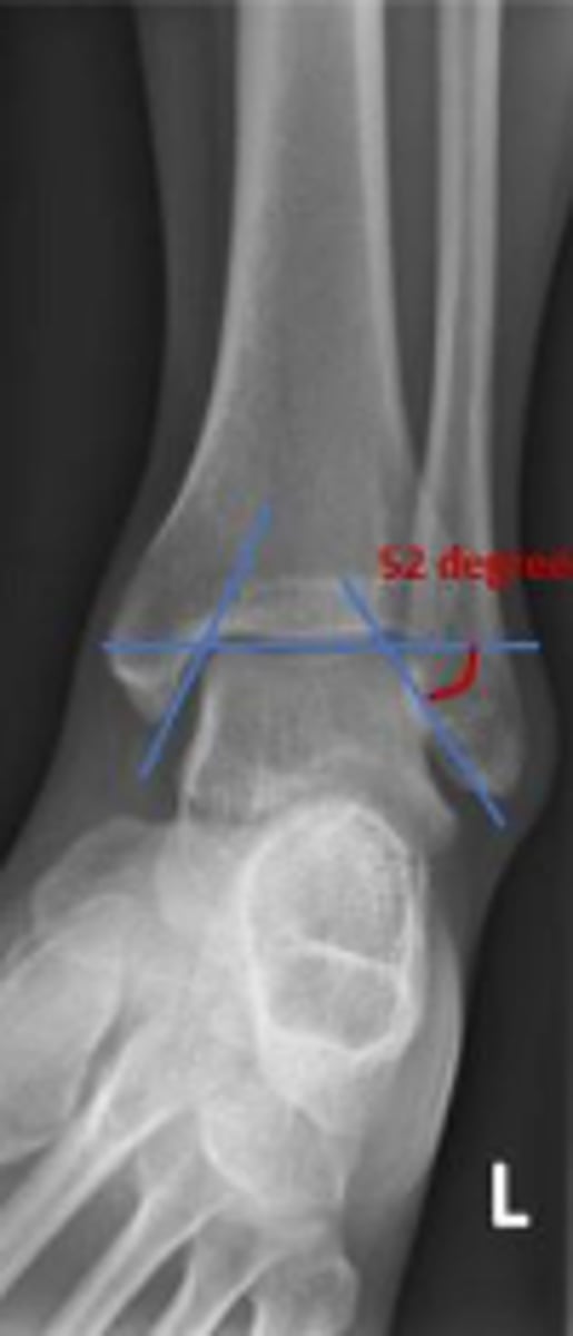 <p>Is the assessment within normal limits?</p>