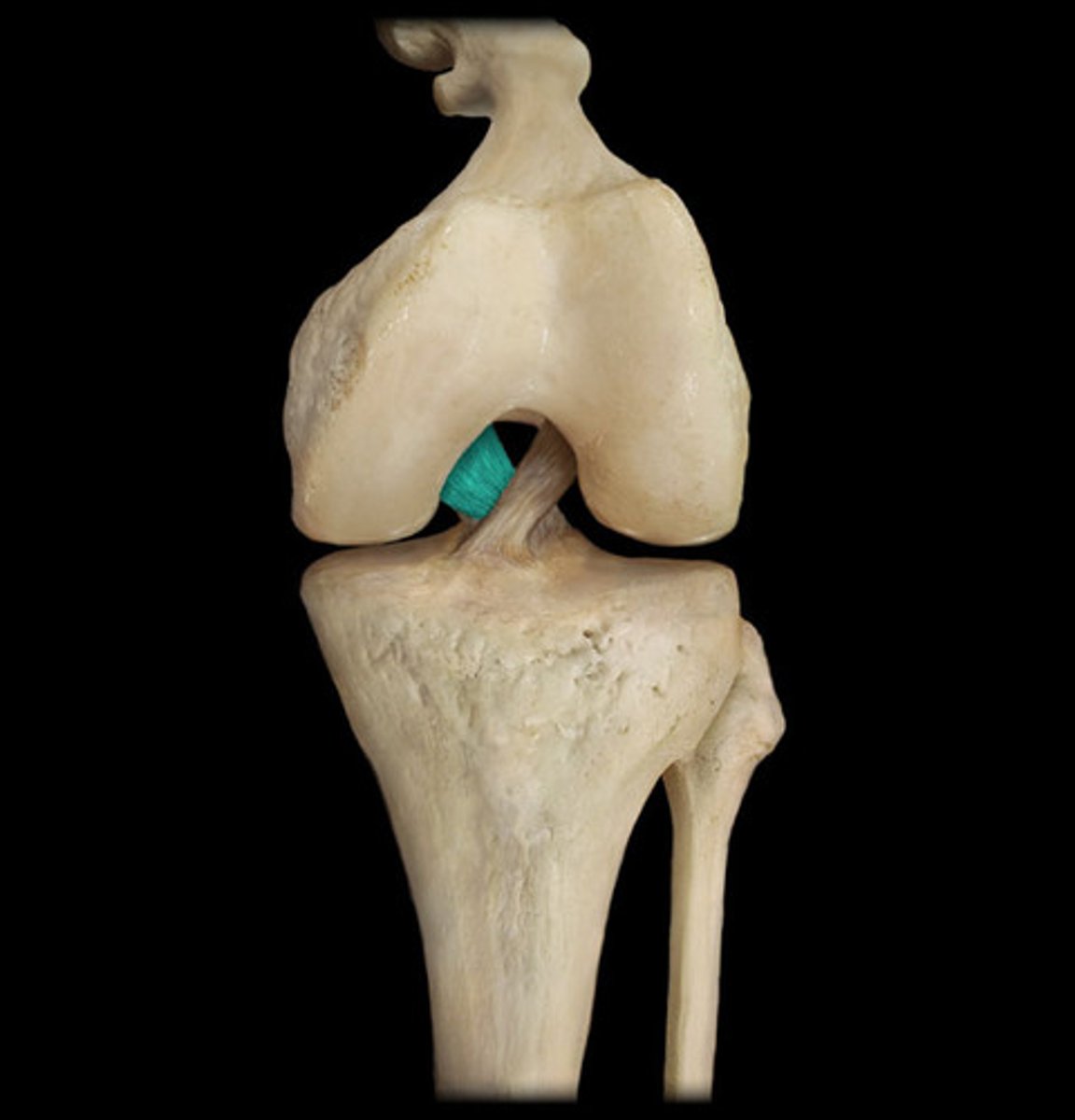 <p>- ligament running from the posterior aspect of the intercondylar area of the tibia to the lateral surface of the medial femoral condyle</p><p>- prevents anterior displacement of the femur on the tibia and hyperextension of the knee cap</p>