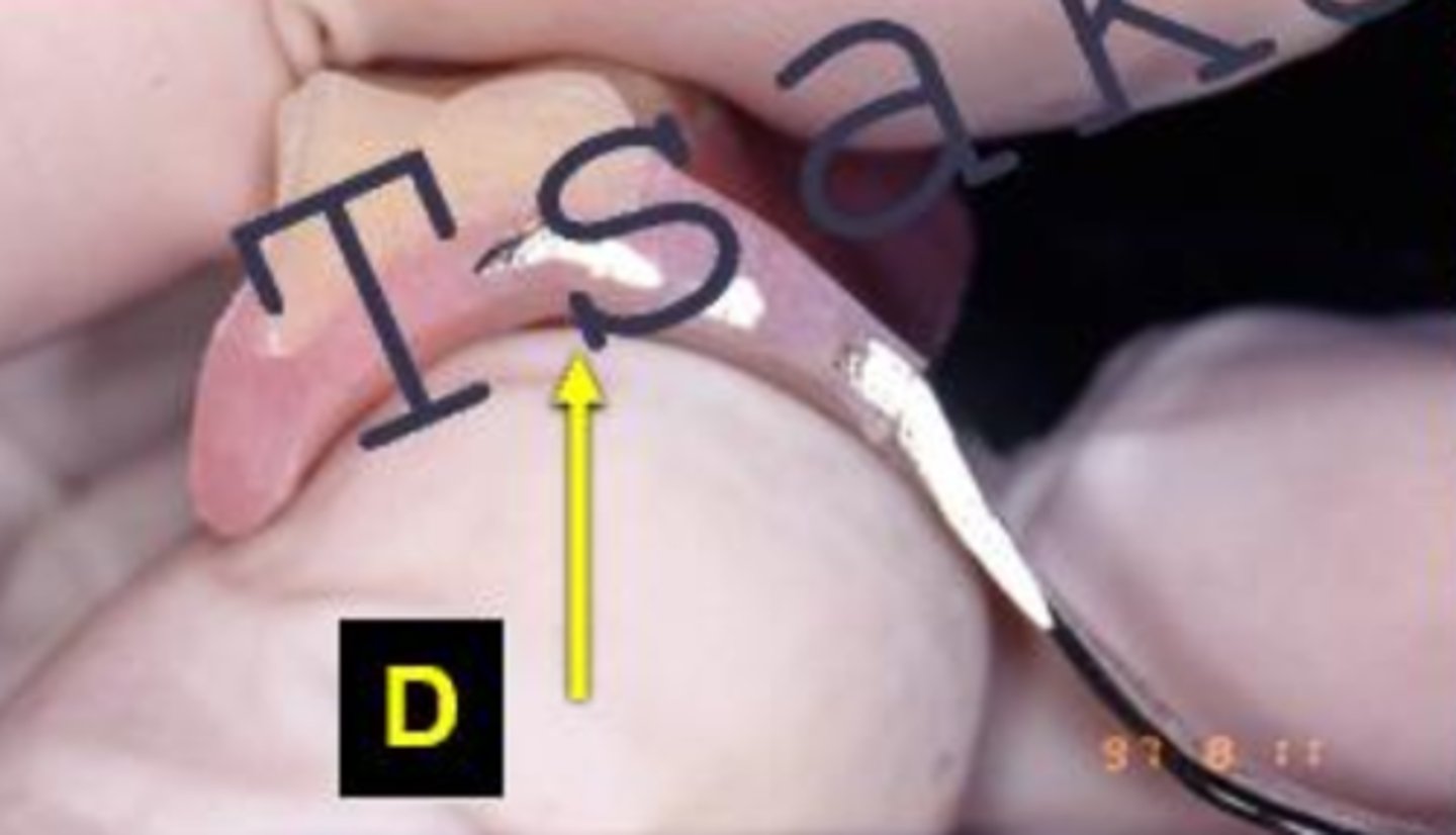 <p>ID the type of block out at D:</p>