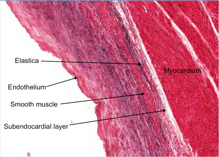 Subendocardial layer