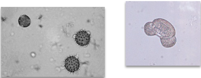 <ul><li><p class="">Large, spherical with distinct cell wall</p></li><li><p class="">Often contain <strong>concentric circles</strong></p></li><li><p class="">Morphology may vary (can appear spiked or lobulated)</p></li><li><p class="">May be mistaken for parasitic ova or other large cells</p><p class=""></p></li></ul><p></p>