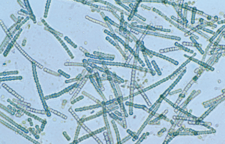 <p>Anabaena</p>