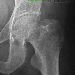 <p>Which way is the leg rotated in this image? </p>