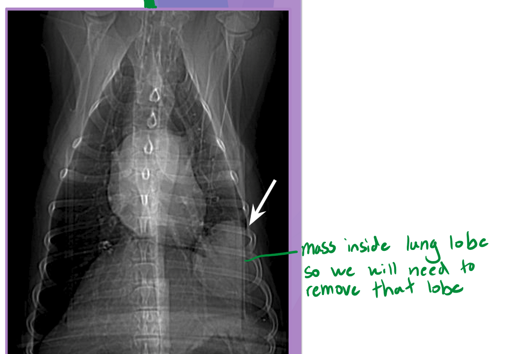 <ul><li><p>Normal lung volume </p><ul><li><p>right lung - 58% </p></li><li><p>left lung - 42%</p></li></ul></li><li><p>lobectomy: partial or complete removal of a lung </p><ul><li><p>dogs easily tolerate up to 58% removal </p></li></ul></li><li><p>compensation occurs via: </p><ul><li><p>hyperinflation of the remaining lung </p></li><li><p>enlargement of the alveolar air spaces </p></li><li><p>thinning of the alveolar capillary tissue barrier </p></li></ul></li><li><p>indications </p><ul><li><p>partial lobectomy </p><ul><li><p>focal lesion at peripheral ½ to 2/3 of lung lobe </p><ul><li><p>neoplasia </p></li><li><p>granuloma </p></li><li><p>bulla </p></li></ul></li><li><p>biopsy </p></li></ul></li><li><p>complete lobectomy </p><ul><li><p>large amount of purulent material (abscess) </p></li><li><p>trauma </p></li><li><p>lung love torsion </p></li><li><p>large / multifocal lesion </p><ul><li><p>neoplasia </p></li><li><p>bulla </p></li></ul></li></ul></li></ul></li></ul><p></p>