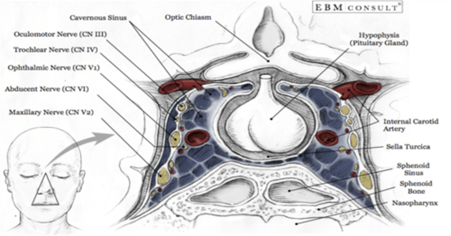 <p>Abducens nerve</p>