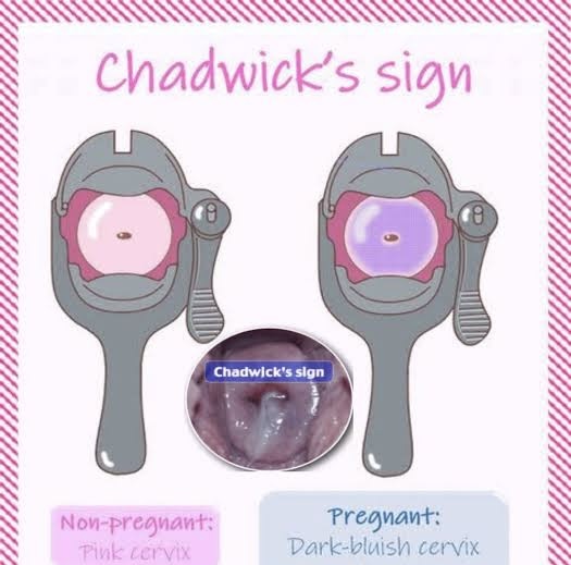 <p>bluish-purple discoloration of the cervix, vagina and vulva</p>